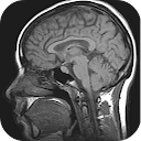 MRI Viewer