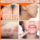 Skin Diseases and Treatment