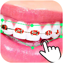 Braces Booth Stickers photo ed