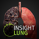 INSIGHT LUNG