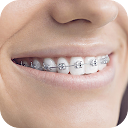 Teeth Braces Photo editor