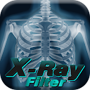 X-ray filter for photos
