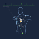 Epicardio Heart Simulator